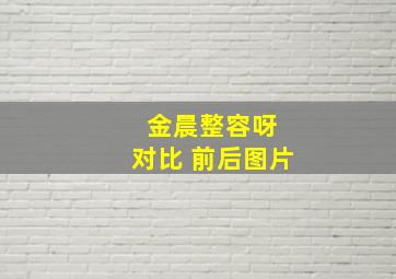 金晨整容呀 对比 前后图片